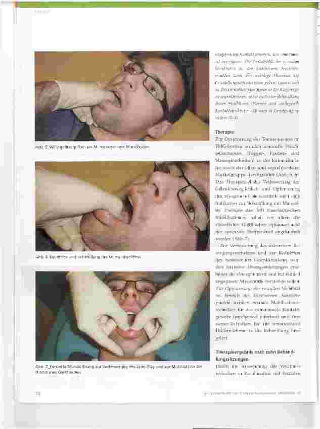 Vorschauseite 5: CMD die Physiotherapie in der interdisziplinären Zusammenarbeit