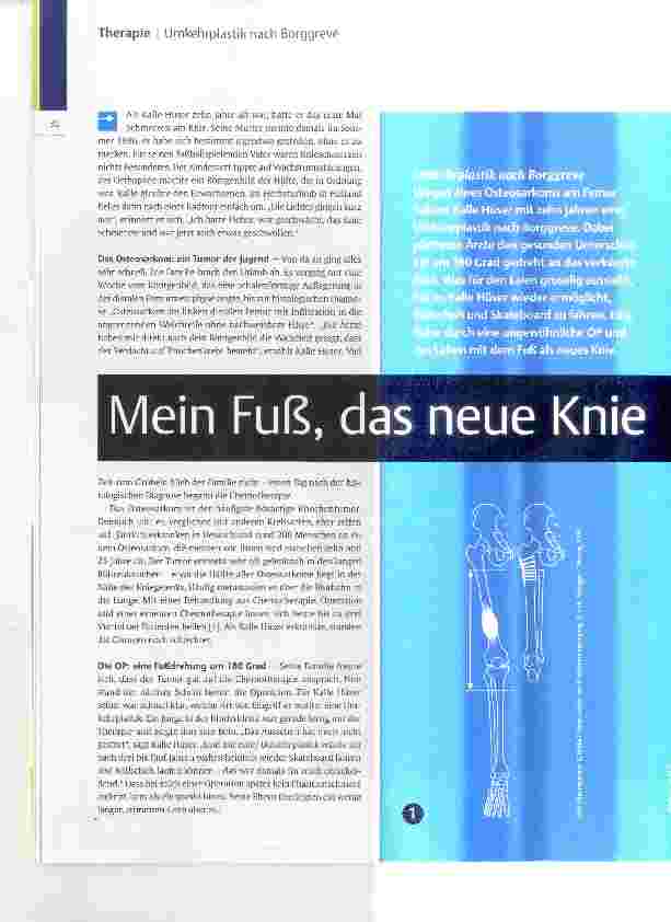 Vorschauseite 1: Mein Fuß, das neue Knie