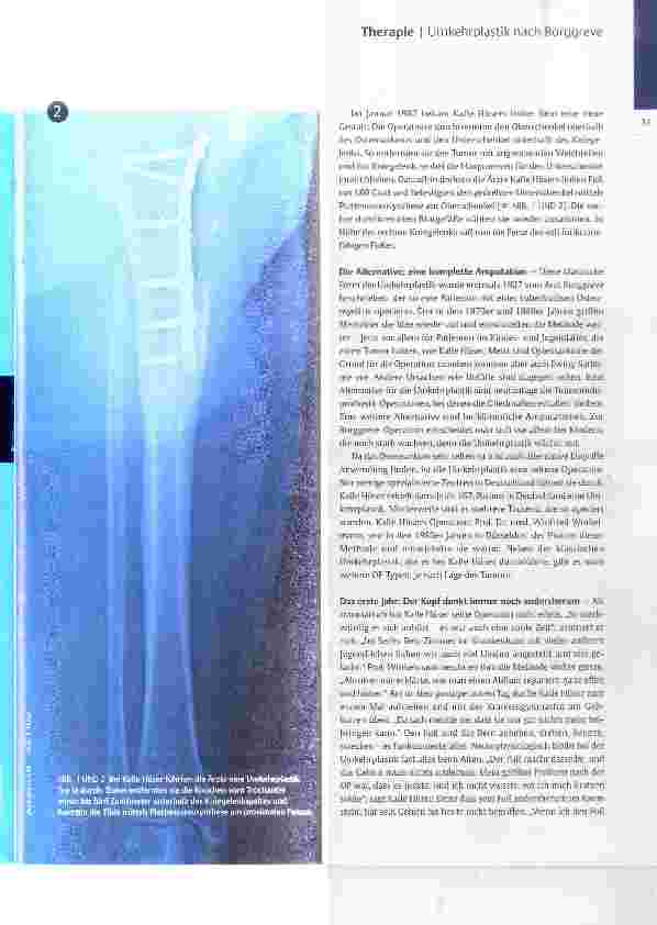 Vorschauseite 2: Mein Fuß, das neue Knie