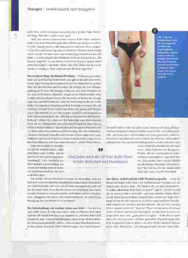 Vorschauseite 3: Mein Fuß, das neue Knie