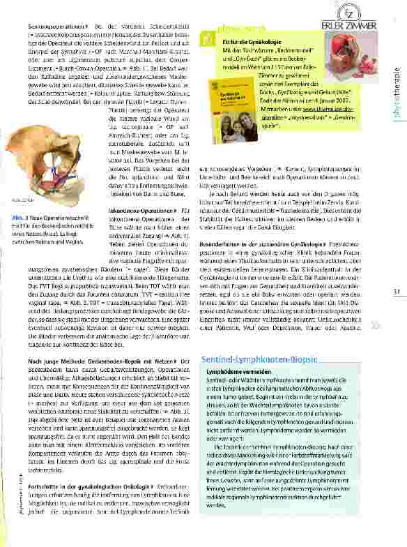 Vorschauseite 2: Mehr als BeckenbodentrainingPhysiotherapie in der operativen Gynäkologie
