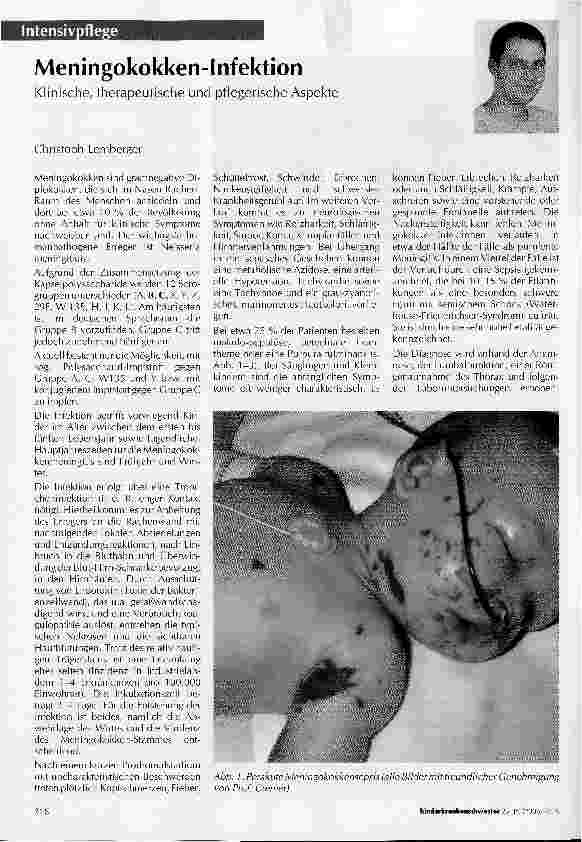Vorschauseite 1: Meningokokken-InfektionKlinische, therapeutische und pflegerische Aspekte
