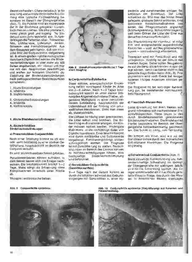 Vorschauseite 3: Einführung in die Augenheilkunde 3. Folge: Die Bindehaut