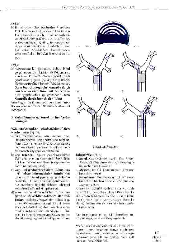 Vorschauseite 2: FIBEROPTISCHE PLATZIERUNG DES DOPPELLUMEN-TUBUS (DLT)