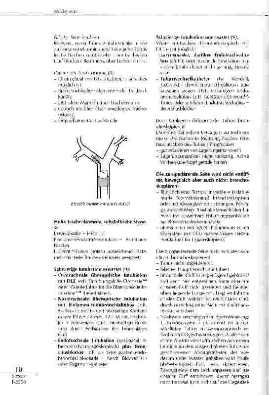 Vorschauseite 3: FIBEROPTISCHE PLATZIERUNG DES DOPPELLUMEN-TUBUS (DLT)