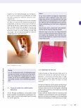 Vorschauseite 5: Narbentherapie am Beispiel der Verbrennungsnarbe