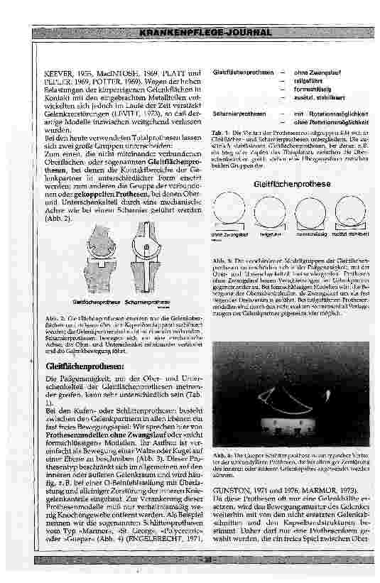 Vorschauseite 2: Besonderheiten der verschiedenen Totalendoprothesen des Kniegelenks