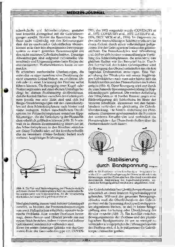 Vorschauseite 3: Besonderheiten der verschiedenen Totalendoprothesen des Kniegelenks