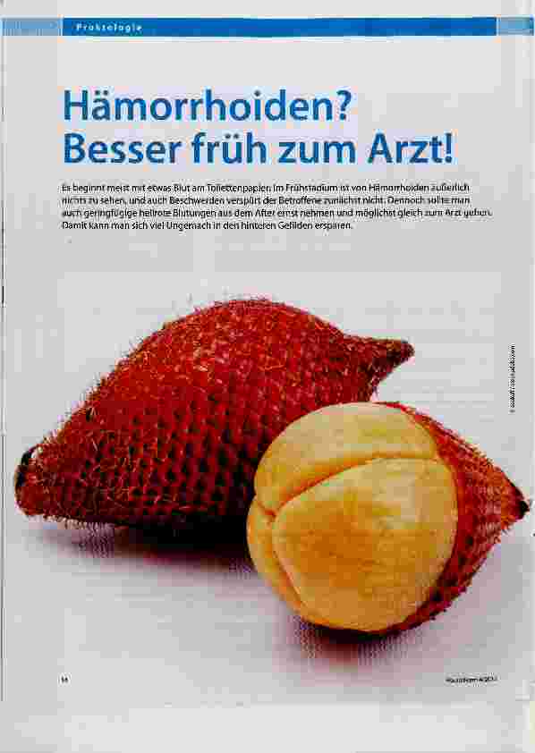 Vorschauseite 1: Hämorrhoiden? Besser früh zum Arzt!