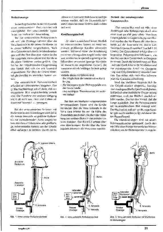 Vorschauseite 5: ARDS Pflegerische Aspekte bei der Behandlung des ARDS mittels extrakorporaler Lungenunterstützung