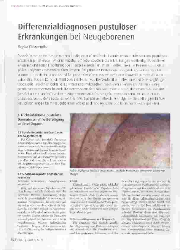 Vorschauseite 1: Differenzialdiagnosen pustulöser Erkrankungen bei Neugeborenen
