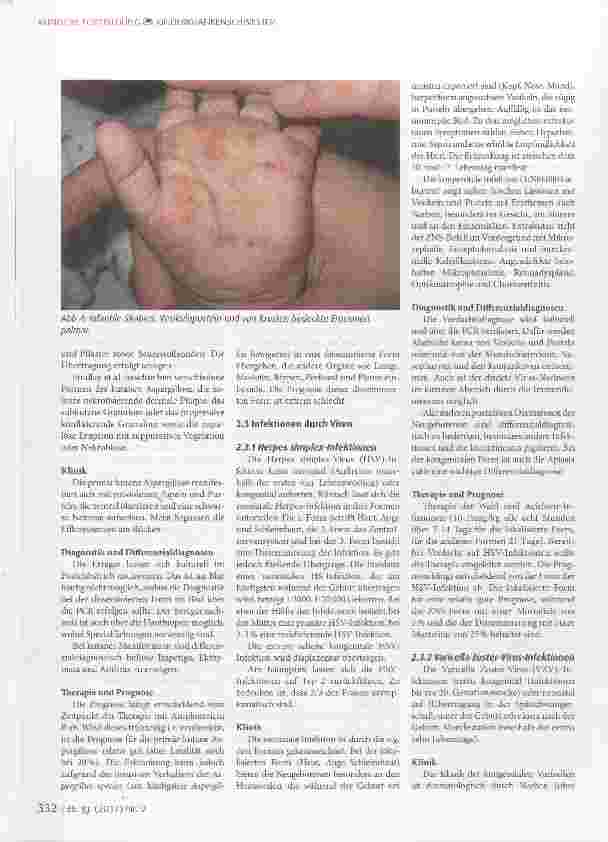 Vorschauseite 5: Differenzialdiagnosen pustulöser Erkrankungen bei Neugeborenen