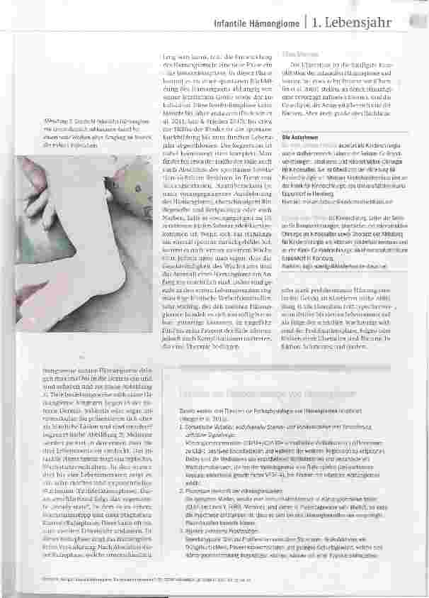 Vorschauseite 2: Infantile Hämangiome Blutschwamm behandeln?