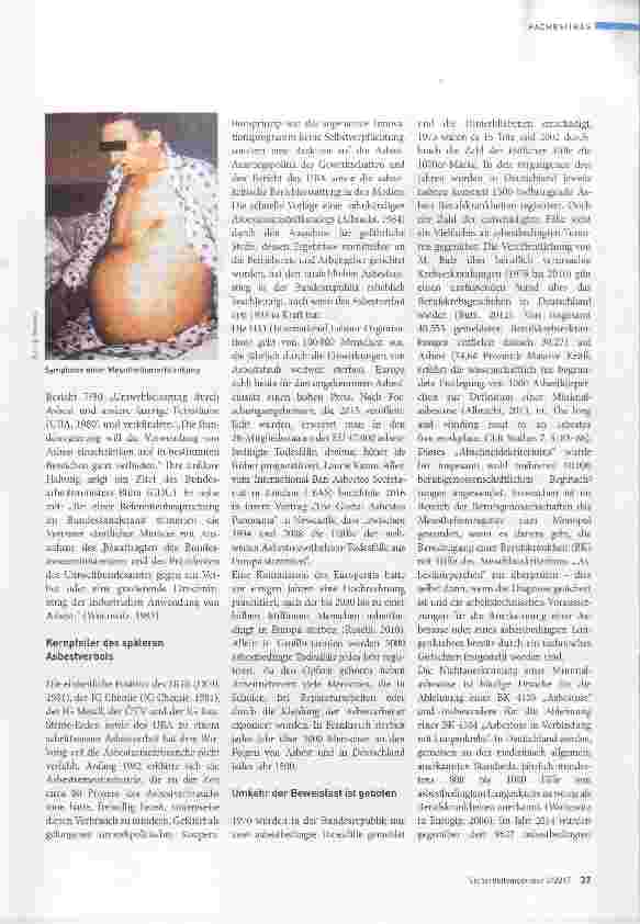 Vorschauseite 4: Vom „Wunderstoff zum Krebsgift ersten Ranges