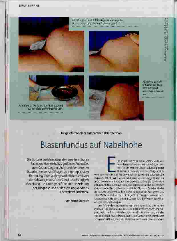 Vorschauseite 1: Blasenfundus auf Nabelhöhe