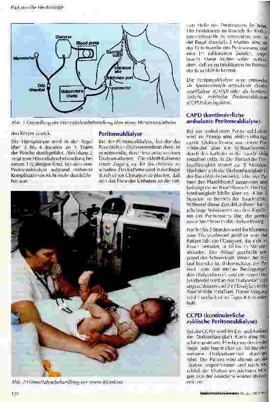 Vorschauseite 2: Nierenersatztherapie