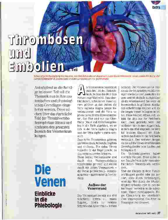 Vorschauseite 1: Thrombosen und Embolien Die Venen