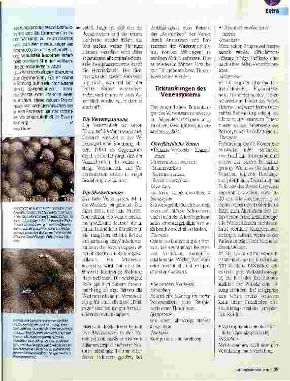 Vorschauseite 3: Thrombosen und Embolien Die Venen