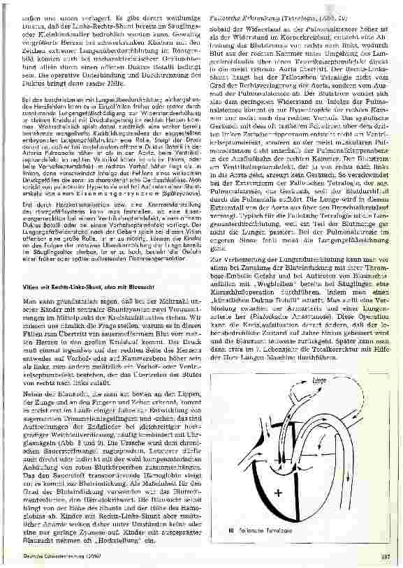 Vorschauseite 5: Angeborene Herzfehler, ihre Diagnose und Therapie