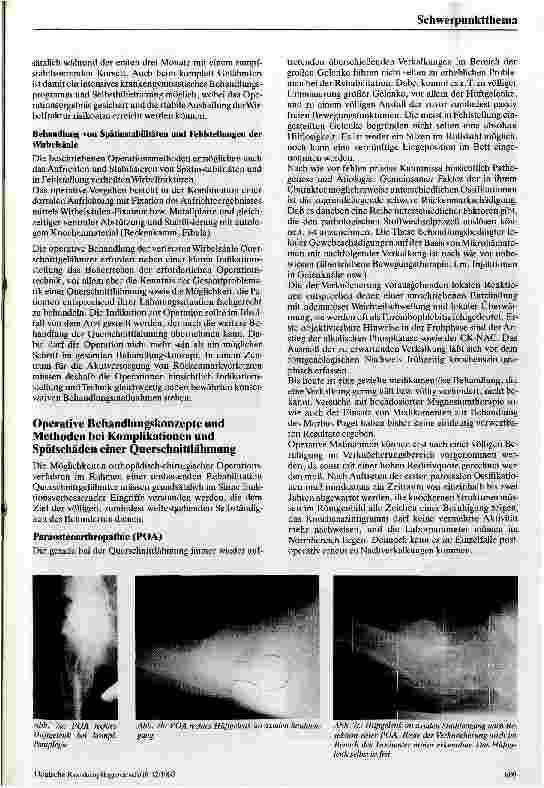 Vorschauseite 4: Operative Maßnahmen bei der Behandlung von Querschnittlähmungen