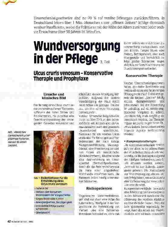 Vorschauseite 1: Wundversorgung in der Pflege 3. Teil Ulcus cruris venosum - Konservative Therapie und Prophylaxe