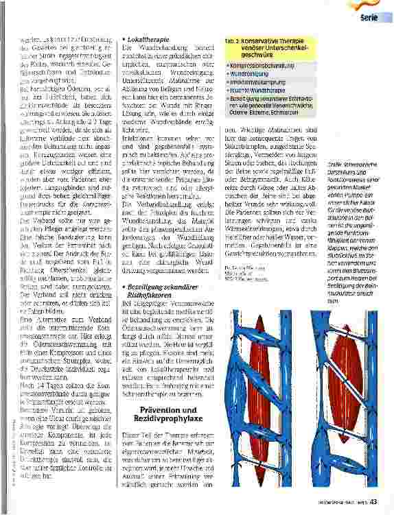 Vorschauseite 2: Wundversorgung in der Pflege 3. Teil Ulcus cruris venosum - Konservative Therapie und Prophylaxe
