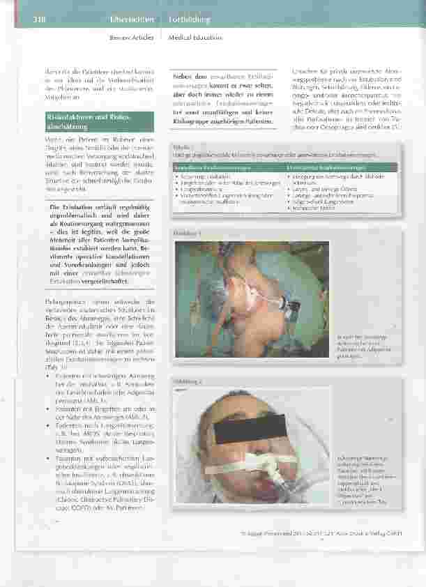 Vorschauseite 2: Extubationsversagen
