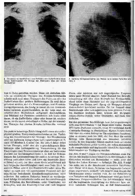 Vorschauseite 5: Zur Diagnostik und Therapie der Herzrhytmusstörungen