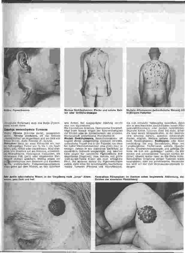 Vorschauseite 2: Der hautkranke Patient 14. Folge: Spezielle Dermatologie: Hauttumore