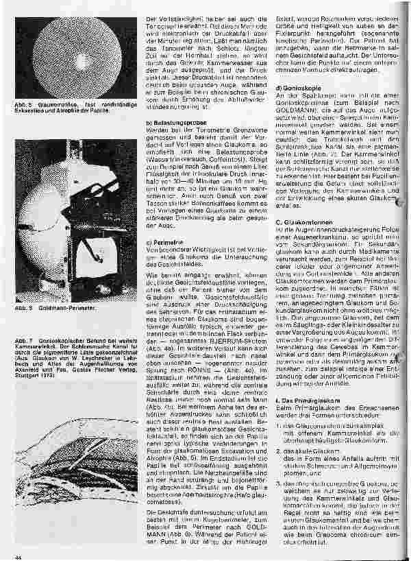 Vorschauseite 3: Einführung in die Augenheilkunde 9. Folge: Das Glaukom - Der grüne Star