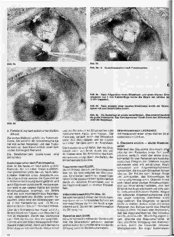 Vorschauseite 5: Einführung in die Augenheilkunde 9. Folge: Das Glaukom - Der grüne Star