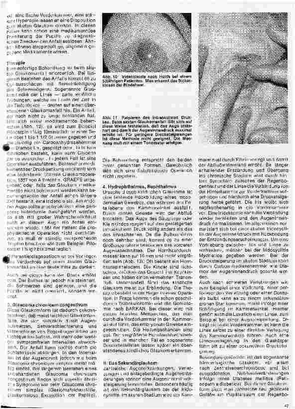 Vorschauseite 6: Einführung in die Augenheilkunde 9. Folge: Das Glaukom - Der grüne Star