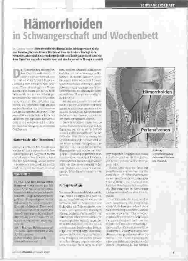 Vorschauseite 1: Hämorrhoiden in Schwangerschaft und Wochenbett