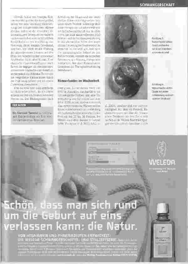 Vorschauseite 3: Hämorrhoiden in Schwangerschaft und Wochenbett