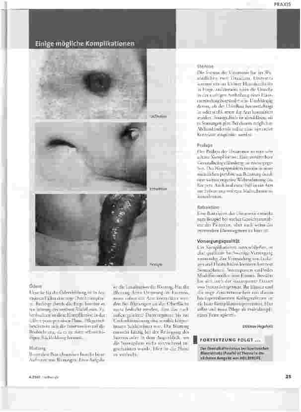 Vorschauseite 2: Komplikationen bei Urostomien