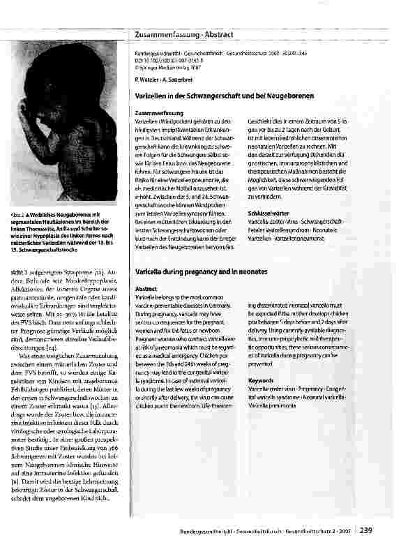 Vorschauseite 3: Varizellen in der Schwangerschaft und bei Neugeborenen