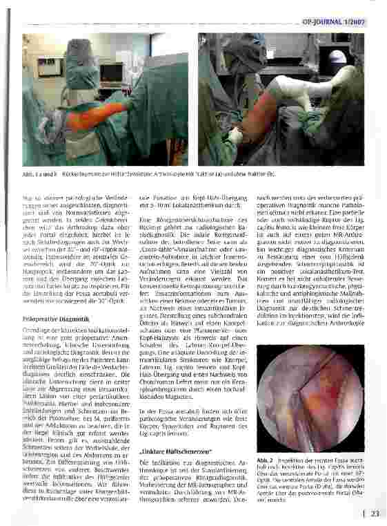Vorschauseite 2: Arthroskopie des Hüftgelenks