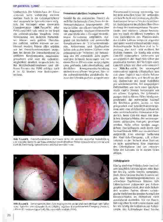 Vorschauseite 5: Arthroskopie des Hüftgelenks