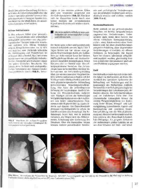 Vorschauseite 6: Arthroskopie des Hüftgelenks