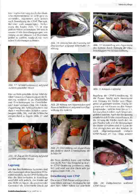 Vorschauseite 4: Binasaler CPAP - Pflege und Systemvielfalf