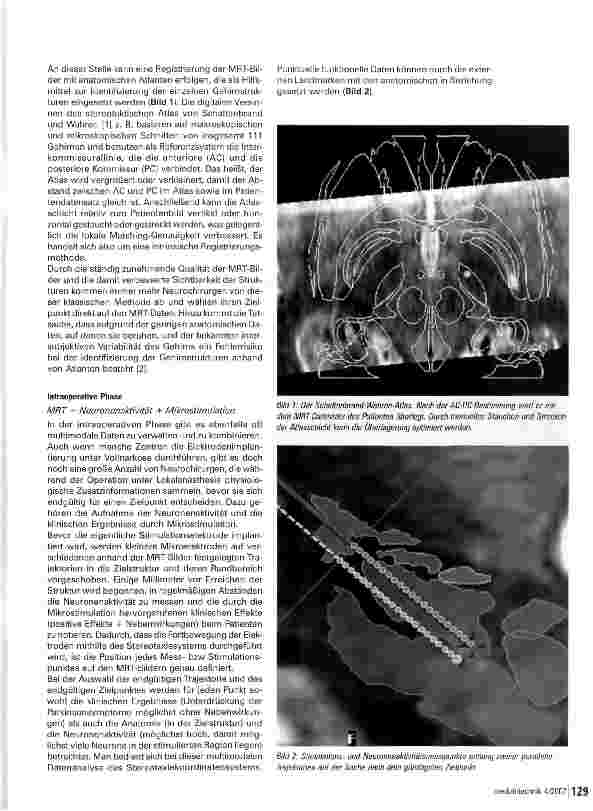 Vorschauseite 2: Darstellung multimodaler Daten des Gehirns