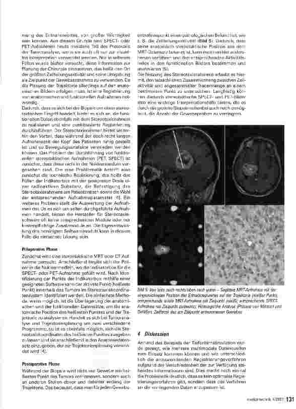 Vorschauseite 4: Darstellung multimodaler Daten des Gehirns