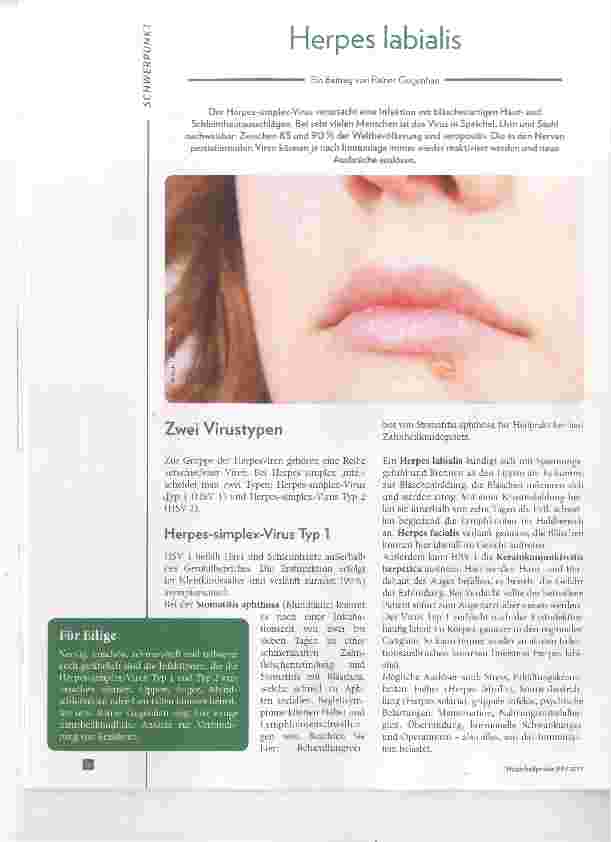 Vorschauseite 1: Herpes labialis