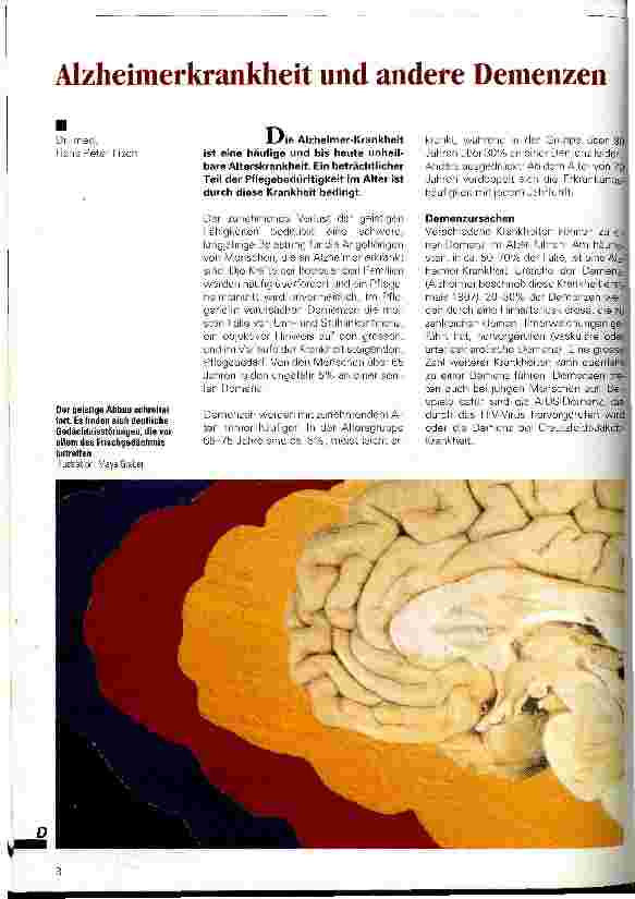 Vorschauseite 1: Alzheimerkrankheit und andere Demenzen