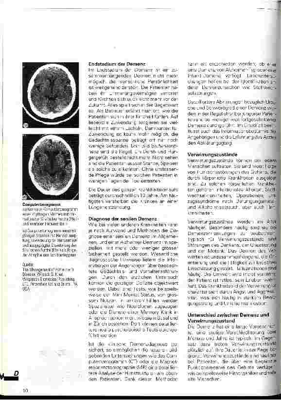 Vorschauseite 3: Alzheimerkrankheit und andere Demenzen