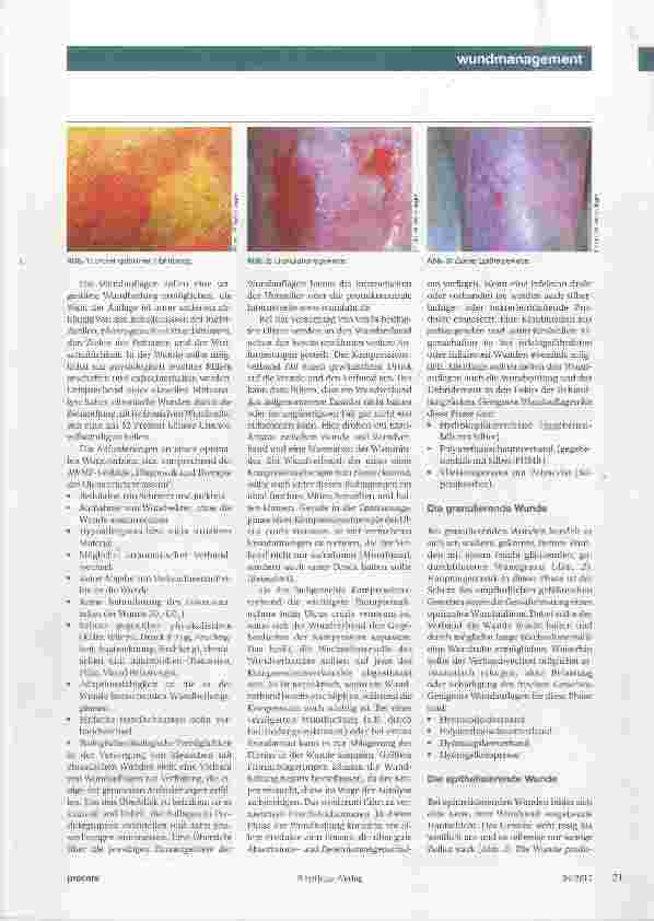 Vorschauseite 2: Wundspülung, Débridement, Wundauflage