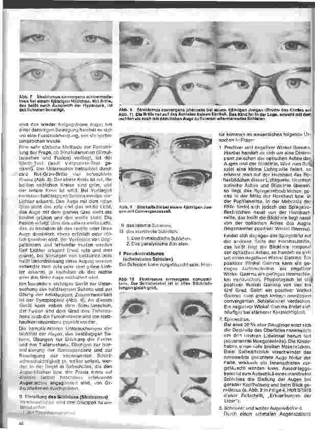 Vorschauseite 3: Einführung in die Augenheilkunde 11. Folge: Motilitätsstörungen der Augen (I)
