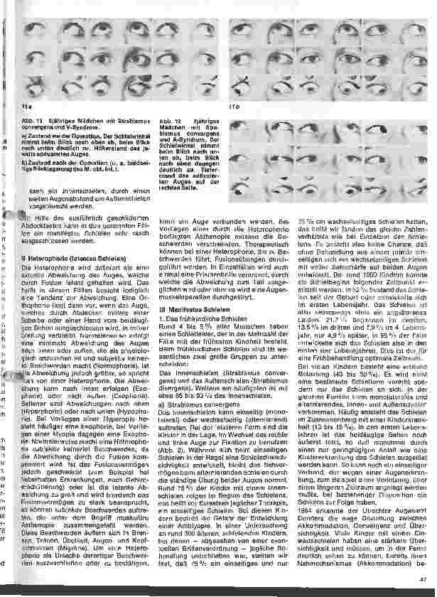 Vorschauseite 4: Einführung in die Augenheilkunde 11. Folge: Motilitätsstörungen der Augen (I)
