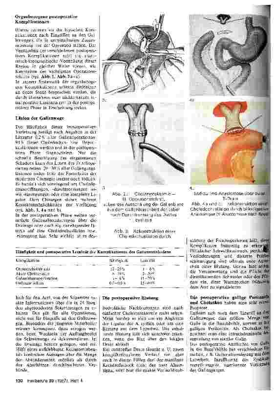 Vorschauseite 2: Postoperative Komplikationen nach Gallenblasenoperationen
