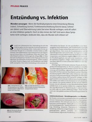 Vorschauseite 1: Entzündung vs. Infektion
